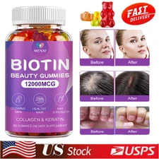 3 Pack Vitamatic Biotin Gummies 12000 mcg for Stronger Hair Skin Nails 60 Vegan