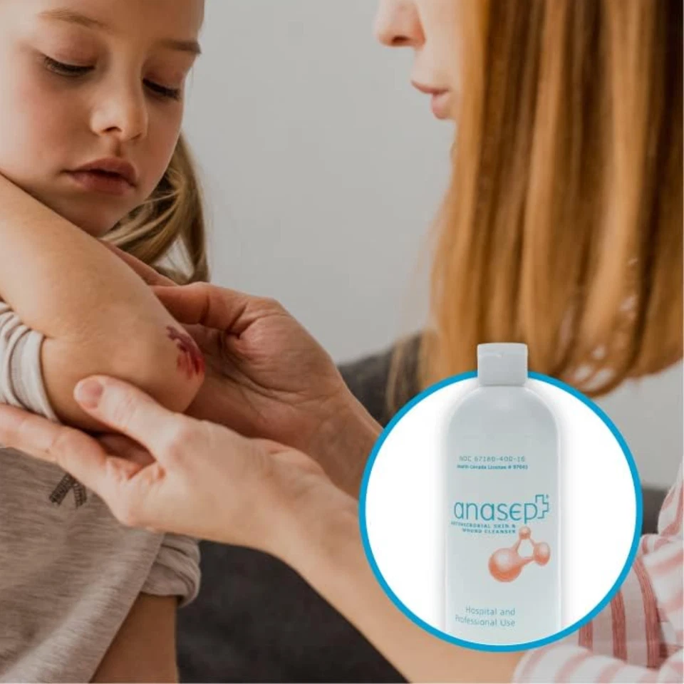 Botella limpiadora de heridas suave Anasept® con tapa dispensadora, 15 oz Foto 3 de 3