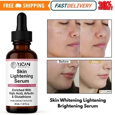 KOJIC ACID Skin Whitening Lightening Brightening Serum Bleaching/Spot Fade Cream