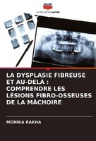 LA Dysplasie Fibreuse ET AU-DELÀ : Comprendre LES LÉSions FIBRO-OSSEUSES DE LA M