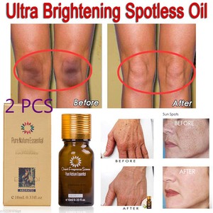 dark spot on legs removal cream