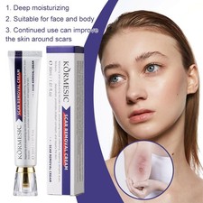 Scar Removal Cream Lightening Hydrating Cream Reduce Dullness NEW V8F0