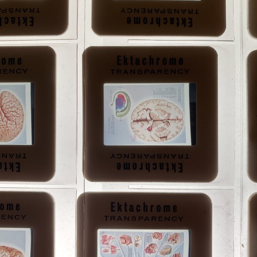 Vintage Medical Slides - Picture 8 of 19