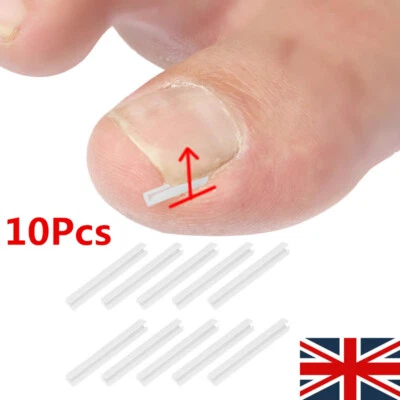 YANQUEENS 10x Ingrown Toenail Corrector Strips Nail Groove Pad Lifter Foot Care UK