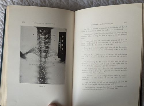 CHIROPRACTIC SPINOGRAPHY Vol X 3rd Ed 1921 E. A. Thompson PALMER SCHOOL - Picture 8 of 8