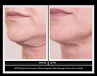 Kleem Organics - Anti-Aging Neck Firming Cream with Peptides and Hyaluronic A...