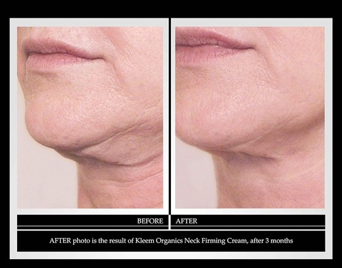 Kleem Organics - Anti-Aging Neck Firming Cream with Peptides and Hyaluronic A...