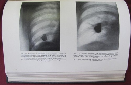 RARE ILLUSTRATED BOOK RUSSIAN ARMY WW2 MEDICAL EXPERIENCE v.9 CHEST GUNSHOTS - Picture 7 of 24