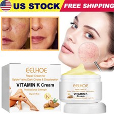 Vitamin K Cream - Eliminate Spider Varicose Veins Scars Rosacea Capillaries