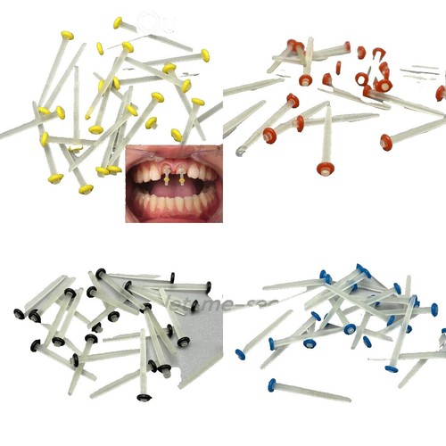 White Delrin Rods, 200 Mm, 1000 Mm At ₹ 50/kg In Vadodara | ID - Foto 2