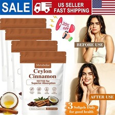 Metabolae Ceylon Cinnamon Capsules   300 Softgels, Supports Metabolic Balance