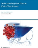 Brian I. Carr | Understanding Liver Cancer | Taschenbuch | Englisch (2014) | Xv