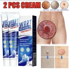 Wart Remover Fast Acting Gel Wart Remover Freeze Off - Fast-Acting Wart Ointment