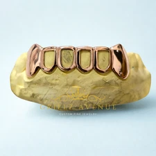 Custom FIT Grillz  Open Face 925 Sterling SILVER ( ROSE GOLD Plated )