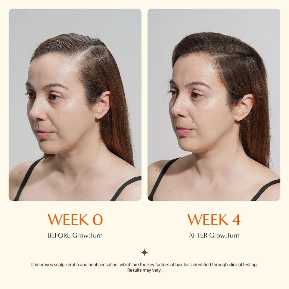 Suero capilar Growturn con cepillo incorporado para crecimiento y engrosamiento del cabello | Tratamiento... Foto 4 de 4