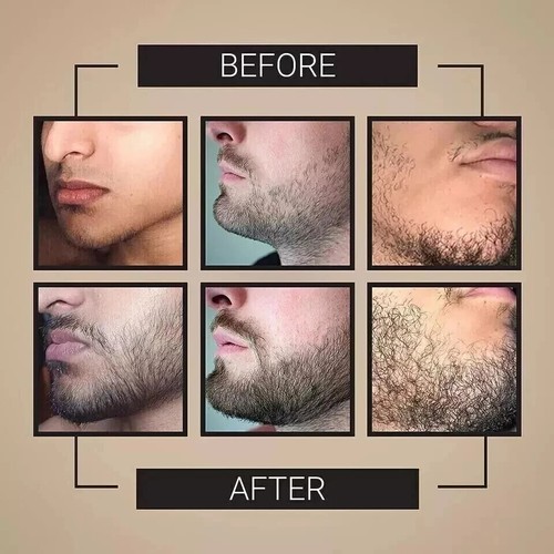 Men Beard Growth Supplement Grow Fuller & Thicker Hair With Nutrients & Vitamins - Picture 3 of 9