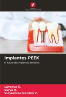 Lavanya S. (U. A.) | Implantes Peek | Taschenbuch | Portugiesisch (2023)