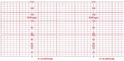 ecg paper 112mm x 100mm x 100 sheets 5 819069014091 ebay