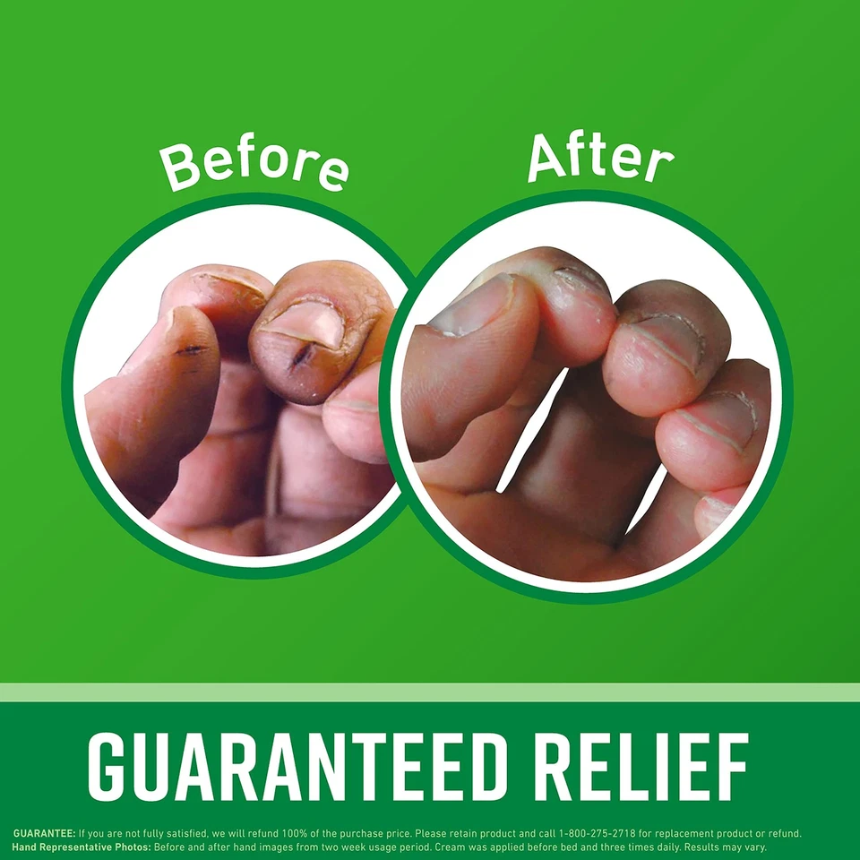 Crema de manos O'Keeffe's Working Hands, tarro de 3,4 onzas, (paquete 1) Foto 2 de 4