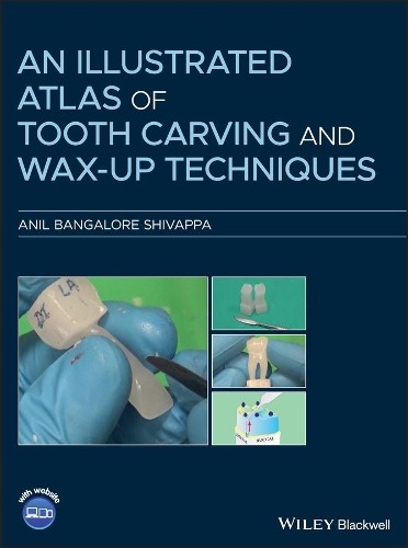 An Illustrated Atlas of Tooth Carving and Wax-Up Techniques - 9781119573586 - Afbeelding 1 van 1