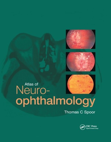 Atlas of Neuro-ophthalmology - 9780367394349