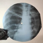 LED ZEPPELIN RAMBLE ON X-Ray USSR Record Roentgen Bone Ribs Music Vinyl