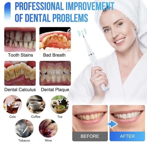 Electric Toothbrush Ultrasonic Tooth Cleaner Teeth Stains Plaque Remover IRELAND - Bild 2 von 10