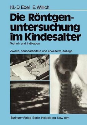 Die Rntgenuntersuchung im Kindesalter: Technik und Indikation by Eberhard Willic