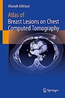 Atlas Of Breast Lesions On Chest Computed Tomography Afsaneh Alikhassi