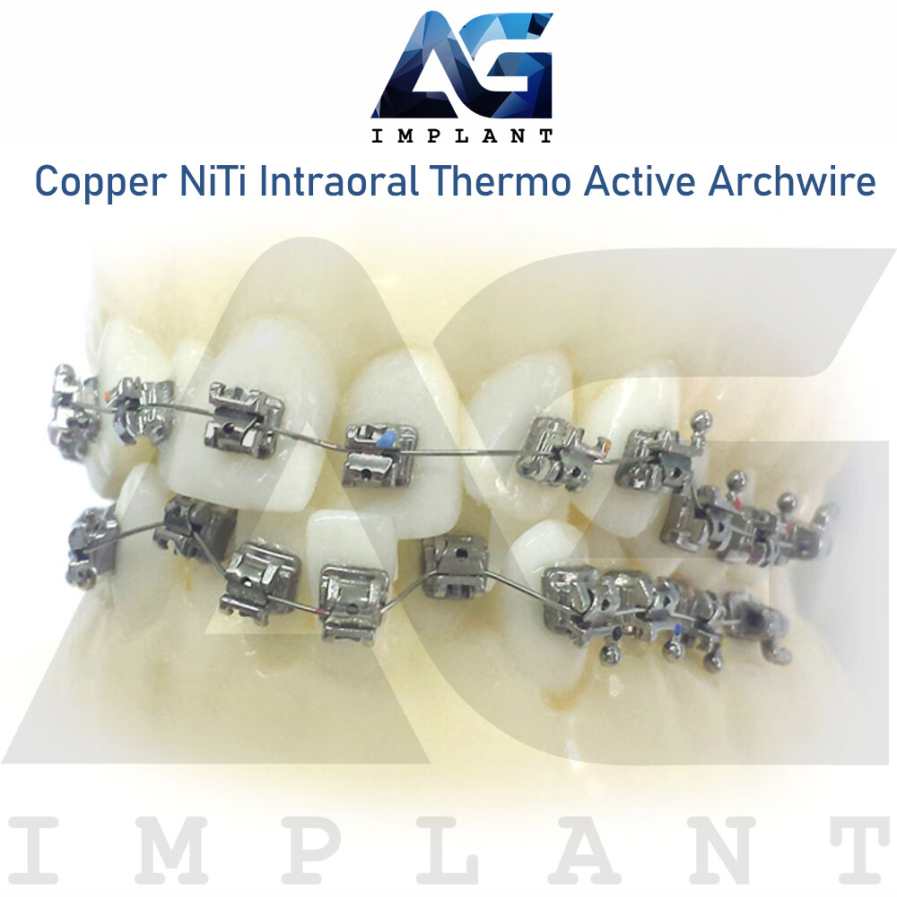 NiTi Copper Intraoral Thermo Active Archwire Round Wire Dental
