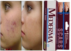 mederma per acne