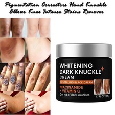 New Strong Whitening Cream For Removing Dark Knuckle Finger Elbow and Knee 50gm