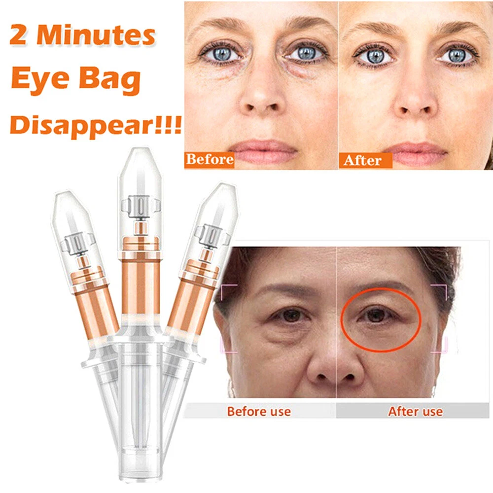 Eye bag cream deals