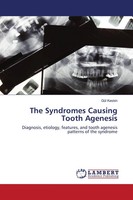 GüL Keskin | The Syndromes Causing Tooth Agenesis | Taschenbuch | Englisch