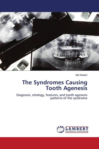 GüL Keskin | The Syndromes Causing Tooth Agenesis | Taschenbuch | Englisch-image