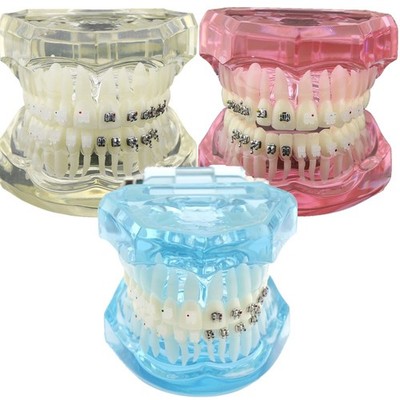 3 Colors Dental Orthodontic Study Model with Metal Ceramic Bracket Braces #3003