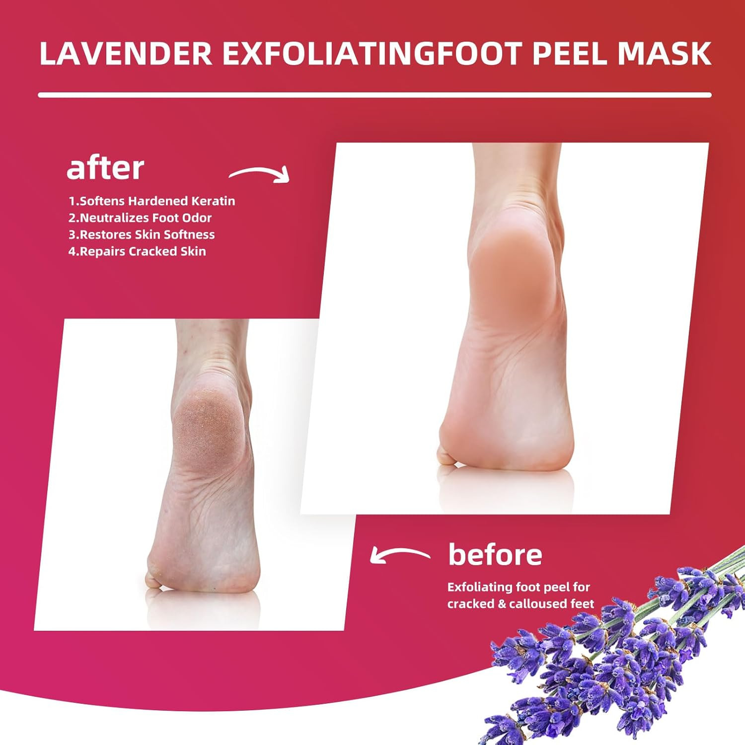 Foot Peel Mask for Dry, Rough Feet – Exfoliating Foot Mask with Fruit Acids, Lav