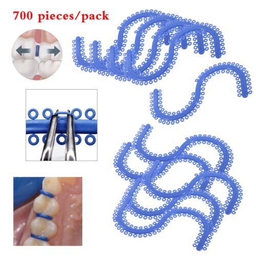 Dental Ortho Separate Tie Blue Color Spacers S-type Supply Teeth Separator hot - Picture 1 of 10