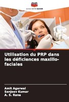 Utilisation Du PRP Dans Les DéFiciences Maxillo-Faciales A. S. Rana