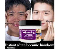 Skin Whitening Cream -Acne Face Cream For Men and Women Instant Results 50g