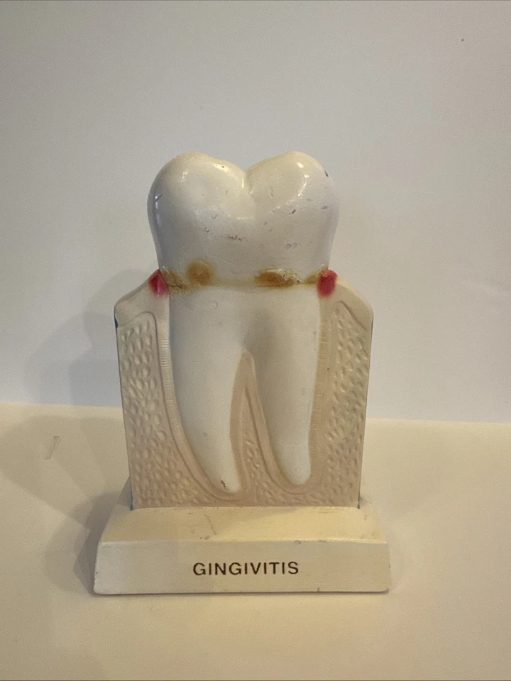 Cepillo de dientes gigante vintage educación dental utilería de exhibición periodontal Foto 3 de 4