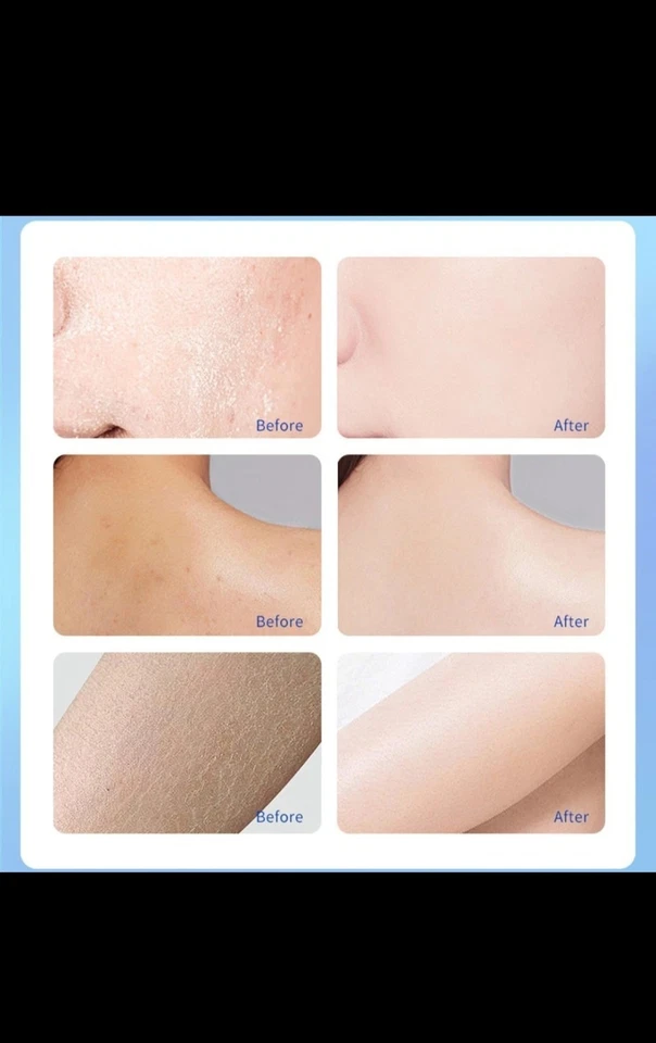 A313 Retinol Cream 50g French Anti - Aging Moisturiser for Smoother Skin - image 3 of 4