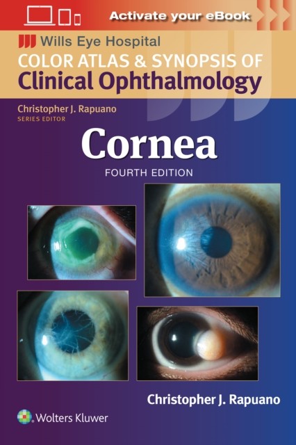 Cornea: Print + eBook with Multimedia by Christopher J, MD Rapuano