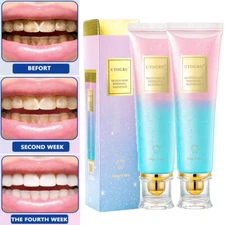 2X Niacinamide Whitening Toothpaste Fresh Breath Toothpaste Teeth Whitening 100g