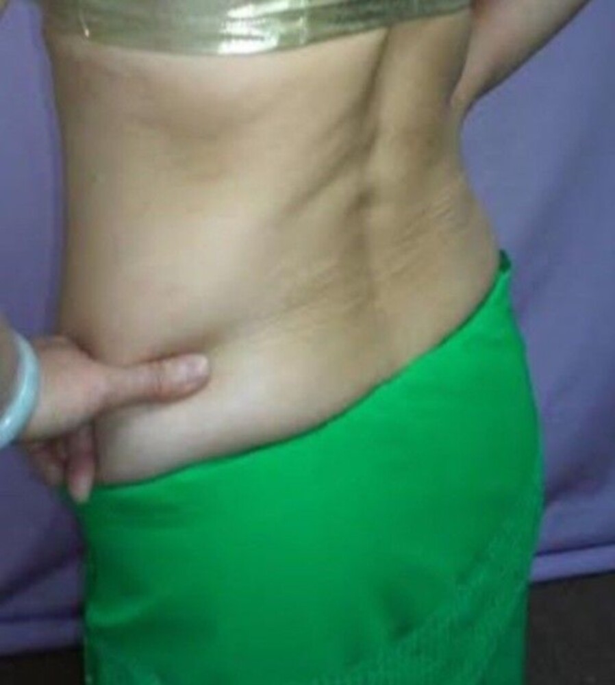 Picture 4 of 18