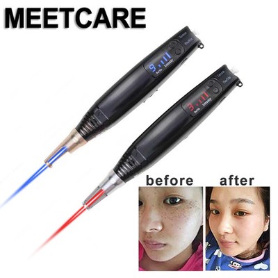 2ND Generation Laser Beauty Pen  Freckle Removal Blue/Red Light Therapy Device