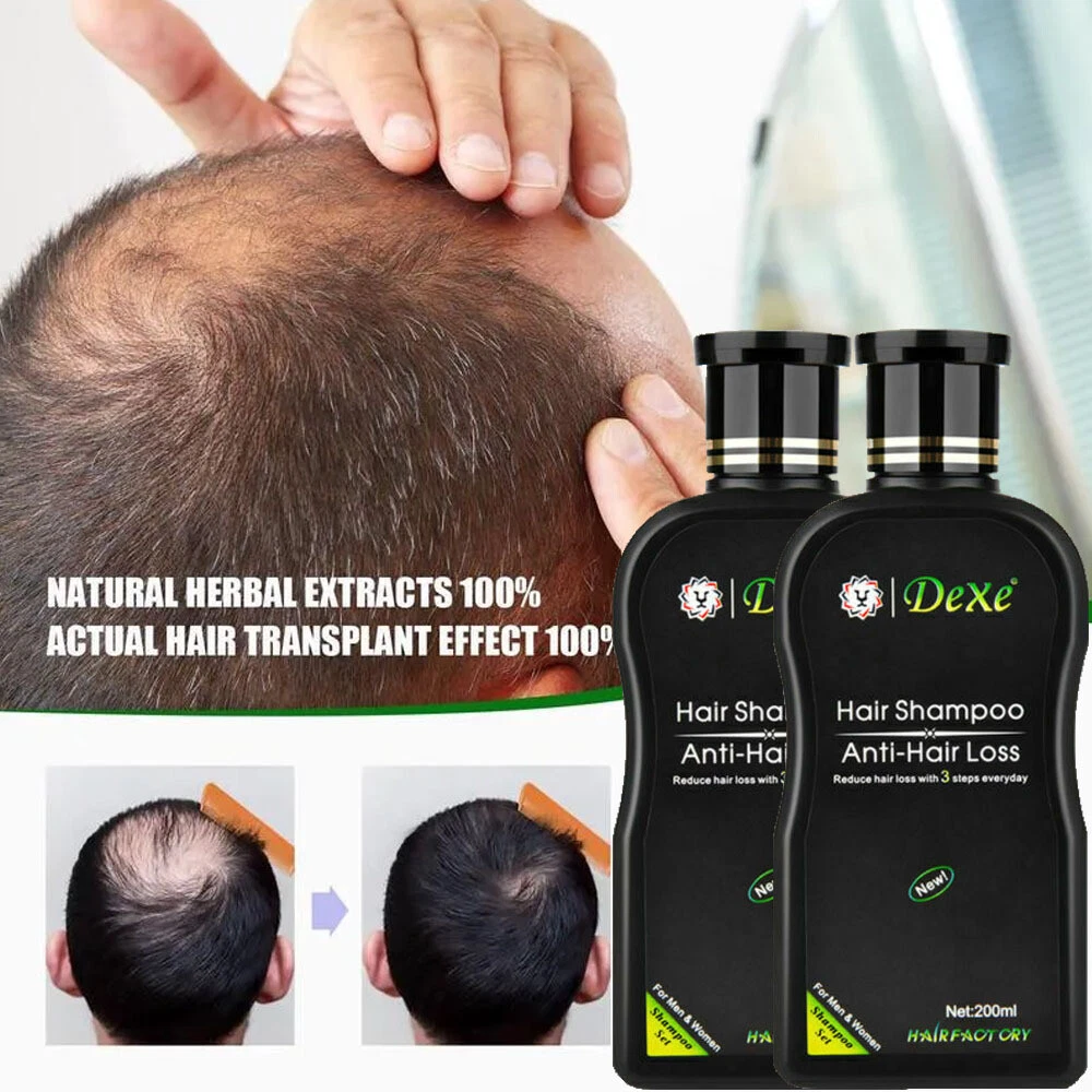 Shampoo for hair regrowth deals