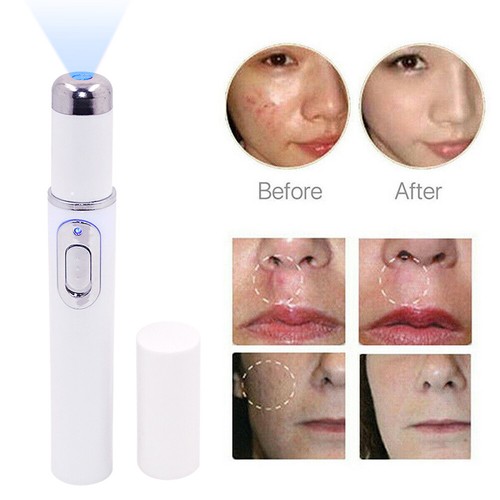 Blue Light Therapy Acne Laser Pen Soft Scar Wrinkle Removal Treatment Device - Picture 2 of 10