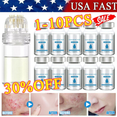 Glamory Micro Infusion System for Face Lips Keep hydrated and Refreshed
