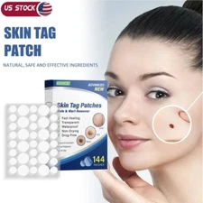 288× Skin Tag Remover Patches Quick Effective Mole and Wart Pad Removal Sticker